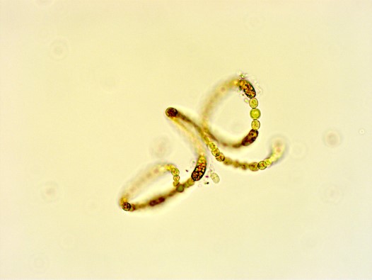 Anabaena flos-aquaea