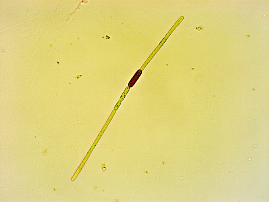 Aphanizomenon flos-aquaea